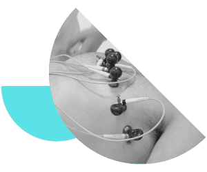 Eletrocardiograma em Parauapebas | Cardio Clinic